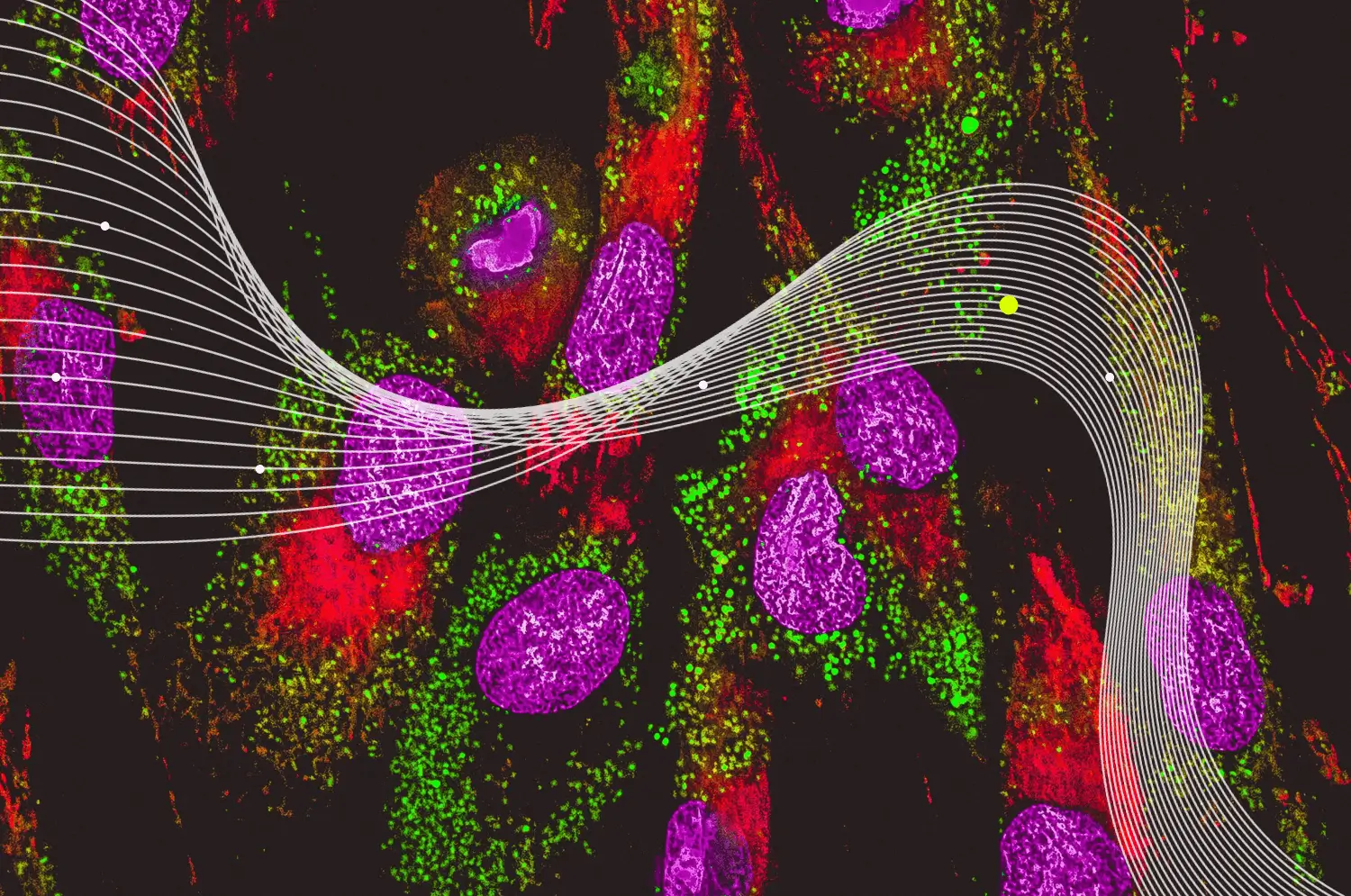 rare disease biomarker