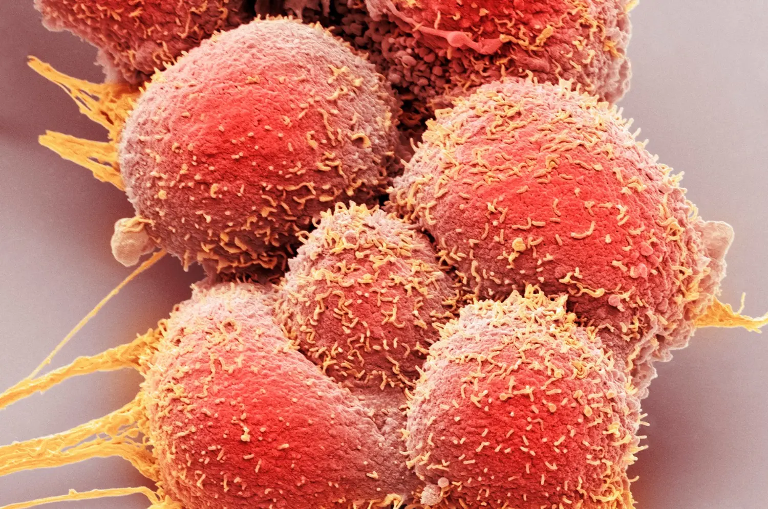 functional tumor biology